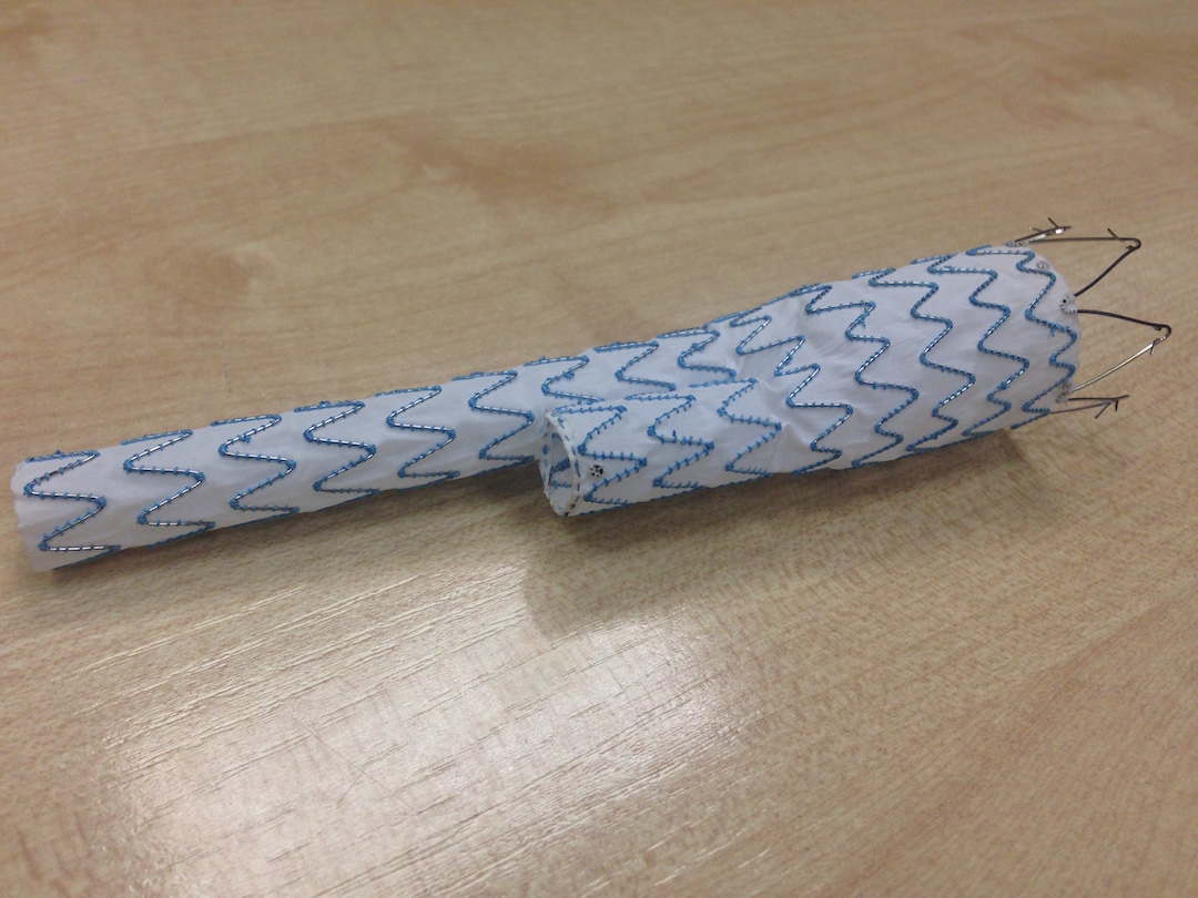 Stent Vascular