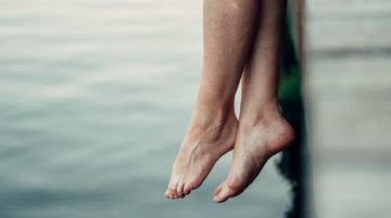 Varices