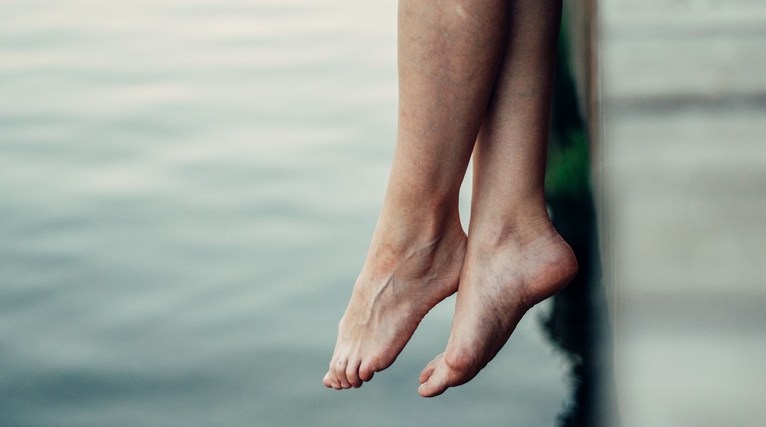 Varices